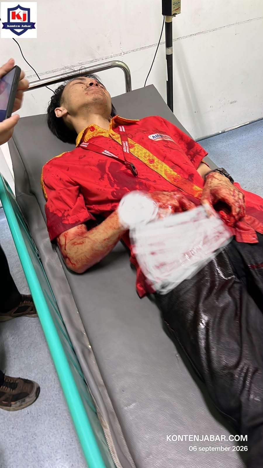Karyawan Alfamart Kopo Soreang Dibacok Perampok, Tangan Hampir Putus